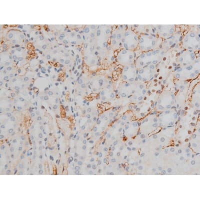 CREB1 / CREB Antibody (phospho-Ser133)