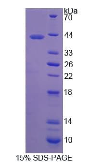 Human ADGRL3 / LPHN3 Protein (Recombinant His)