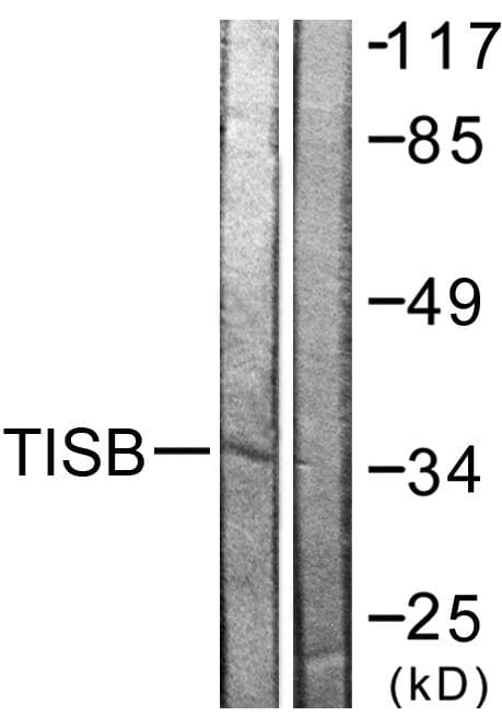 Polyclonal Rabbit anti-Human ZFP36L1 Antibody (p92, IHC, WB)