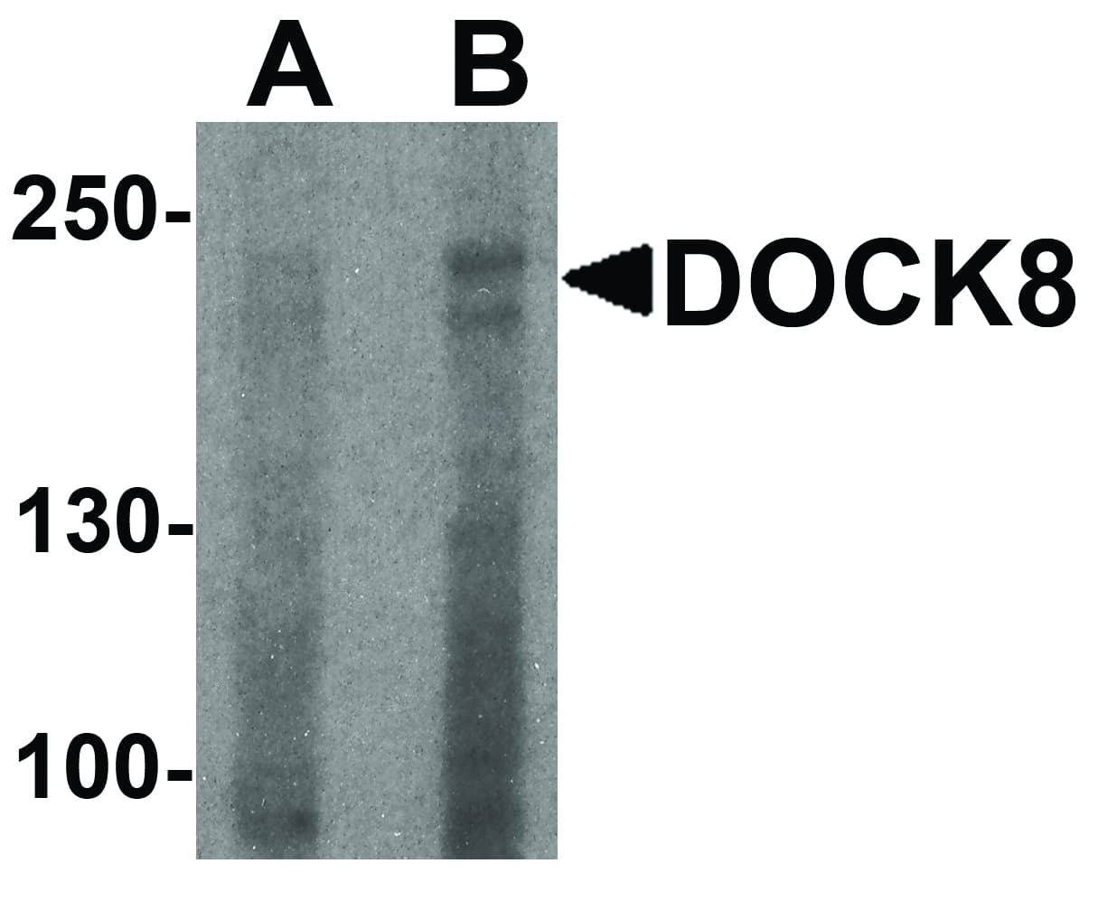 DOCK8 Antibody
