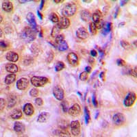 Polyclonal Rabbit anti-Human IRS1 Antibody (Internal, IHC, IF, WB)