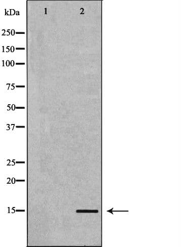NPPB / BNP Antibody