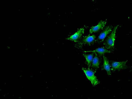 RPL19 / Ribosomal Protein L19 Antibody