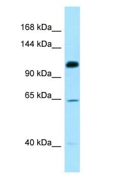 SMC6 Antibody (C-Terminus)