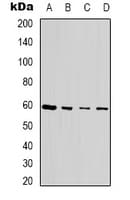 TSEN54 Antibody (Internal)