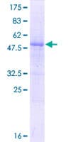 Human RNF115 / BCA2 Protein (Recombinant GST)