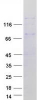 Human DUOX Protein (Recombinant Myc-DDK (Flag))