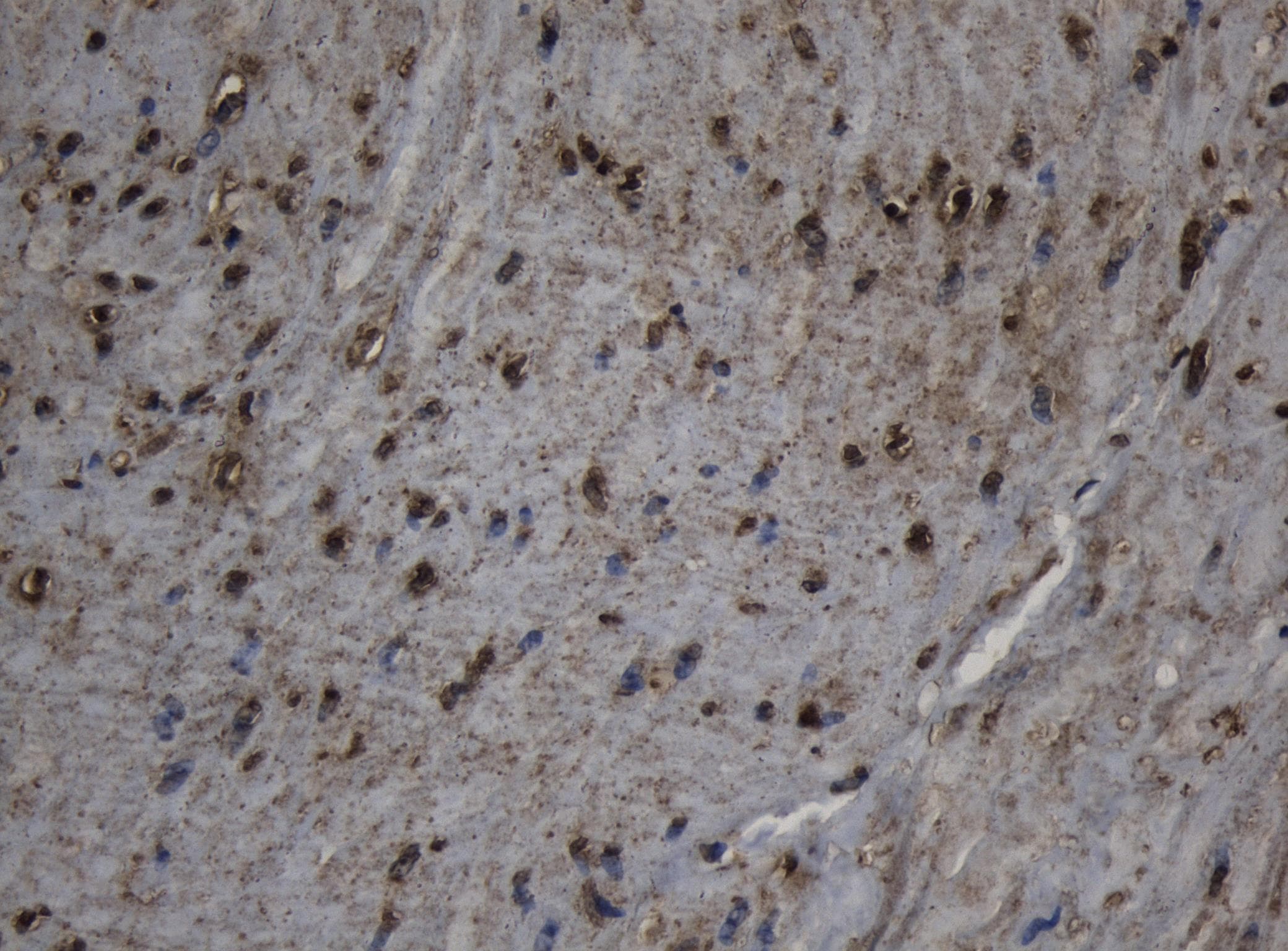 Monoclonal Mouse anti-Human CPT1B Antibody (clone OTI6B8, aa187-440, IHC, WB)