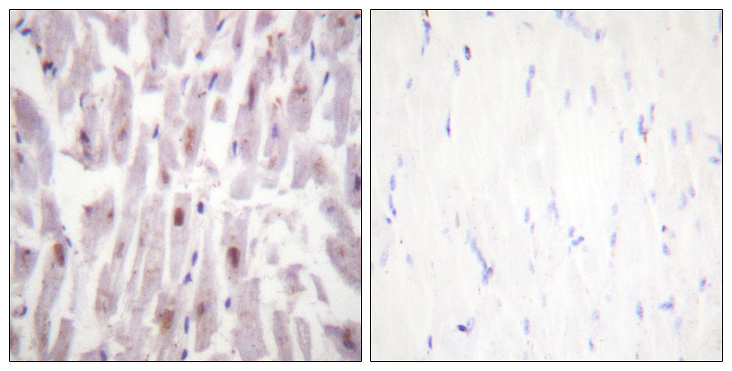 MED1 / TRAP220 Antibody (phospho-Thr1457)
