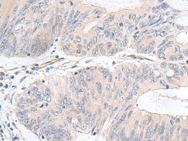 NMU / Neuromedin U Antibody