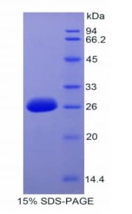 Human IRAK3 / IRAKM / IRAK-M Protein (Recombinant His)