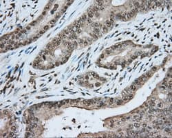 HMRF1L / MTRF1L Antibody (clone OTI2B5)
