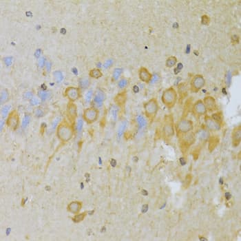Polyclonal Rabbit anti-Human SNAI2 / SLUG Antibody (IHC, IF, WB)