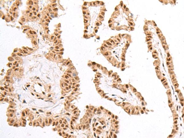 JHDM1A / KDM2A Antibody