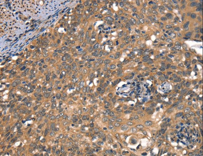 DAAM1 Antibody