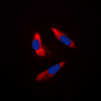 RPS6KB1 / P70S6K / S6K Antibody (Internal)