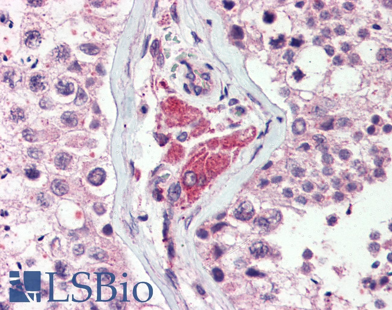 IHC-plus™ Polyclonal Rabbit anti-Human NEK9 Antibody (Pro/Ser/Thr Rich Domain, IHC)