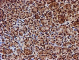 CYP17 / CYP17A1 Antibody (clone OTI3F11)