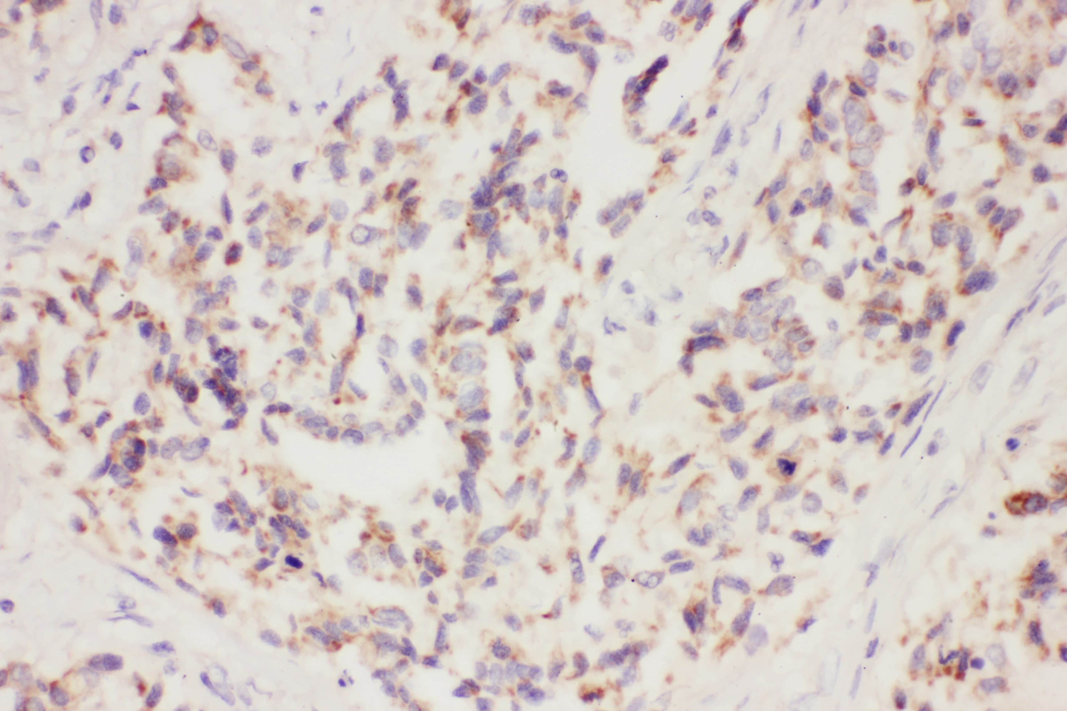 Polyclonal Rabbit anti-Human VEGFA / VEGF Antibody (aa27-191, IHC, WB)