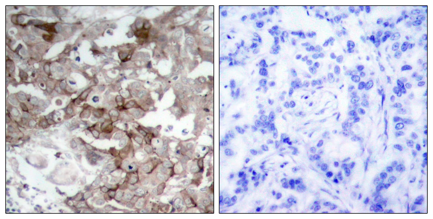 CTTN / Cortactin Antibody (aa441-490)