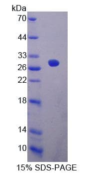 Human EPSTI1 Protein (Recombinant His-T7)