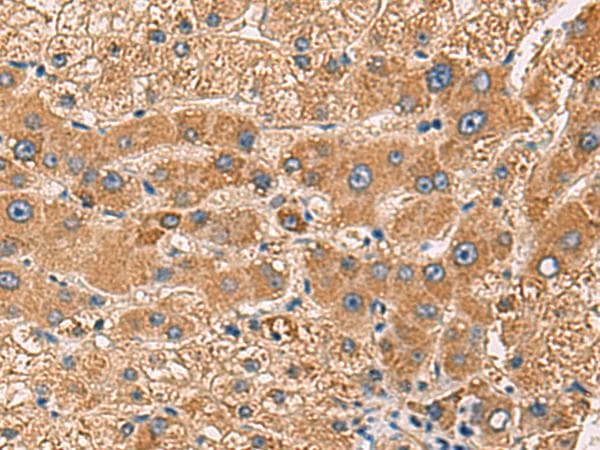 PDHA1 / PDH E1 Alpha Antibody