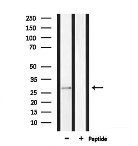 MPZ / P0 Antibody