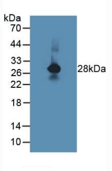 MPZ / P0 Antibody (aa30-248)
