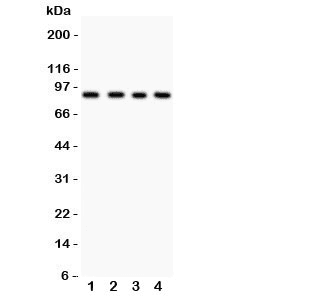 IKBKB / IKK2 / IKK Beta Antibody