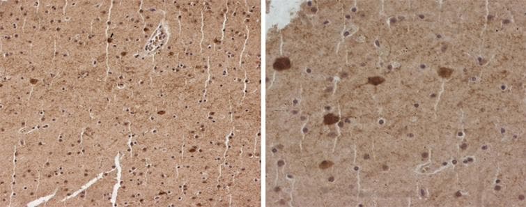 GAD1 / GAD67 Antibody