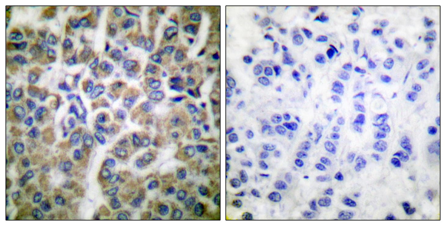 HSP10 / Cpn10 / Chaperonin 10 Antibody