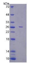 Rat ENPP2 / Autotaxin Protein (Recombinant His-T7)