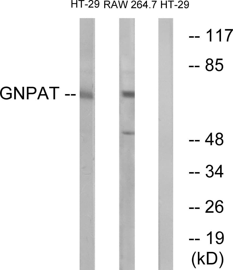 GNPAT / DHAP-AT Antibody (aa231-280)