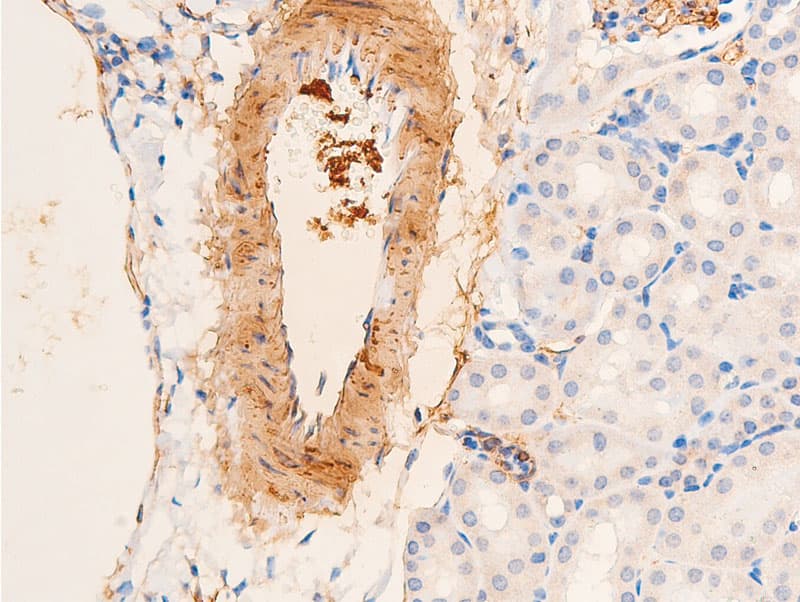 ACTA2 / Smooth Muscle Actin Antibody