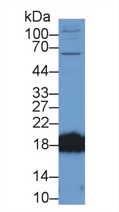 CPLX2 / Complexin 2 Antibody (aa1-134)