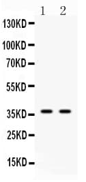 ANXA8 / Annexin A8 Antibody