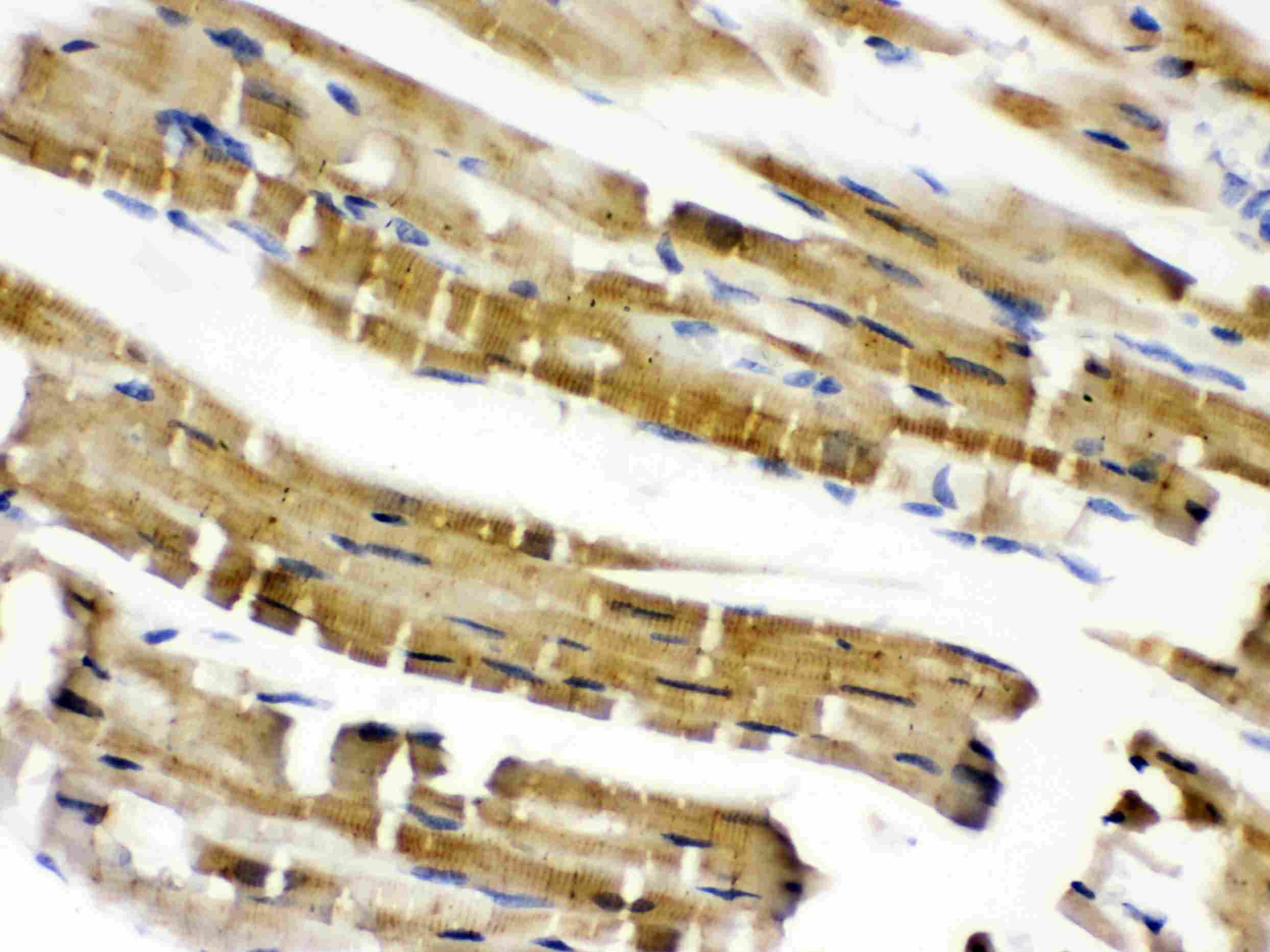 Polyclonal Rabbit anti-Human CFL2 / Cofilin 2 Antibody (IHC, WB)