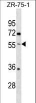 IHC-plus™ Polyclonal Rabbit anti-Human ENTPD5 / CD39L4 Antibody (aa333-362, IHC, WB)
