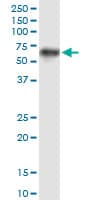 PROC / Protein C Antibody (clone 3A10)