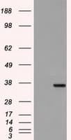 IHC-plus™ CD32A Antibody (clone 13D7)