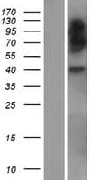 Human HLA-E Protein (Over-Expression Lysate Myc-DDK (Flag))