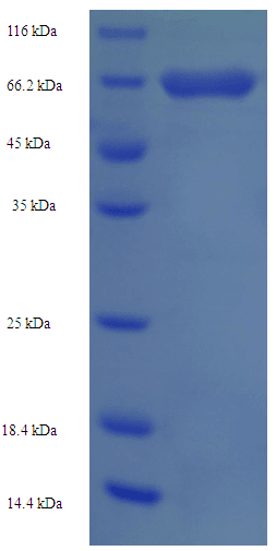 Human HK1 / Hexokinase 1 Protein (Recombinant His-SUMO)