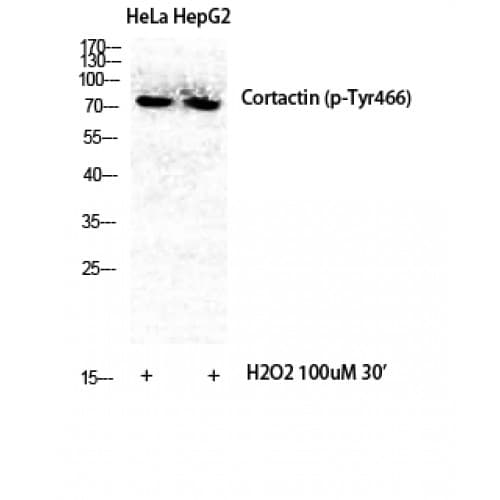 CTTN / Cortactin Antibody (410-490 aa)