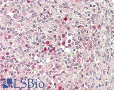 IHC-plus™ Polyclonal Rabbit anti-Human NCF2 / NOXA2 / p67phox Antibody (IHC, IF, WB)