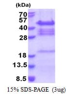 Human QKI Protein (Recombinant His)