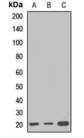 Polyclonal Rabbit anti-Human WRB Antibody (IHC, WB)