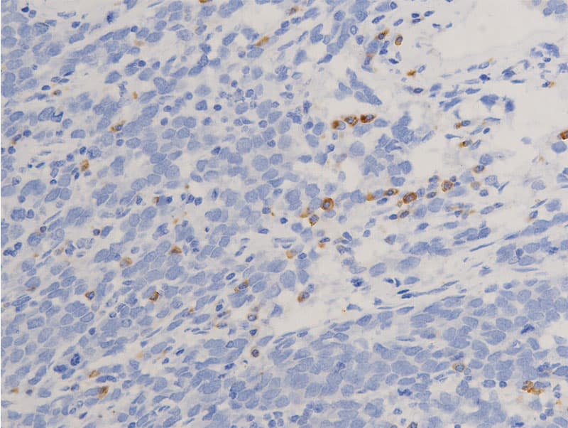 NR3C1/Glucocorticoid Receptor Antibody (phospho-Ser211)