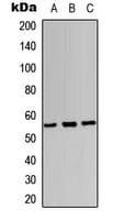 Polyclonal Rabbit anti-Human SOX9 Antibody (Internal, IHC, IF, WB)