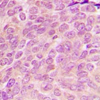 Polyclonal Rabbit anti-Human MRPL54 Antibody (Internal, IHC, WB)
