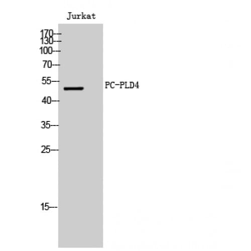 Polyclonal Rabbit anti-Human PLD4 / Phospholipase D4 Antibody (430-510 aa, C-terminal, WB)